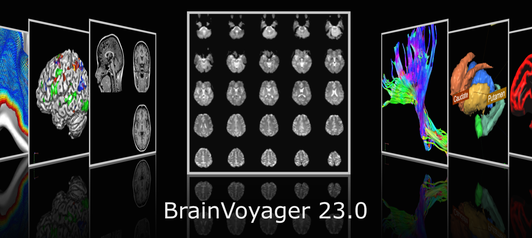 brain voyager analysis